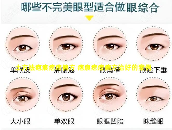 土方祛疤痕疙瘩偏方 疤痕疙瘩偏方治好的案例